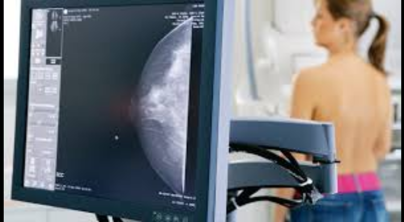 Cerca de 3.000 mamografias serão realizadas em Guaratinguetá